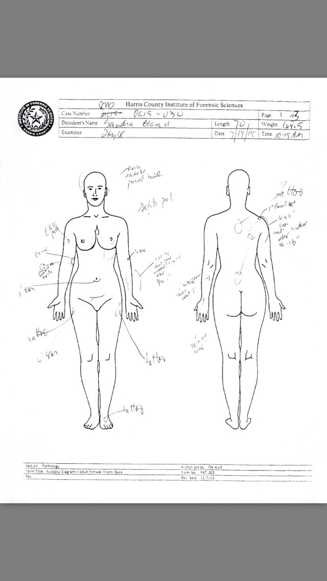 melanieh1:  Black lives matter   #justiceforsandy  This is The autopsy report.  Be