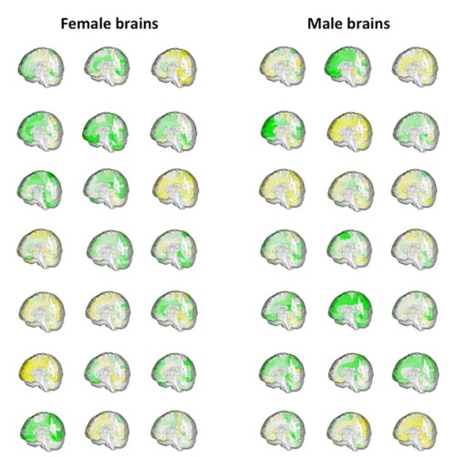 zoologicallyobsessed:ascaloner:micdotcom:Male and female brains aren’t wired differentlyNew re