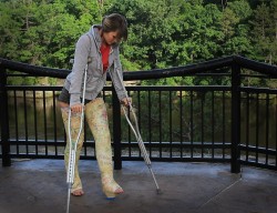 Girl In Double Long Leg Walking Cast And Crutches Outdoorsdllc / Dllwc