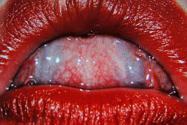 vvni:  Unknown 