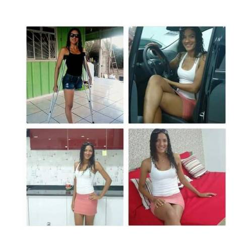 cf-amputees: Keila