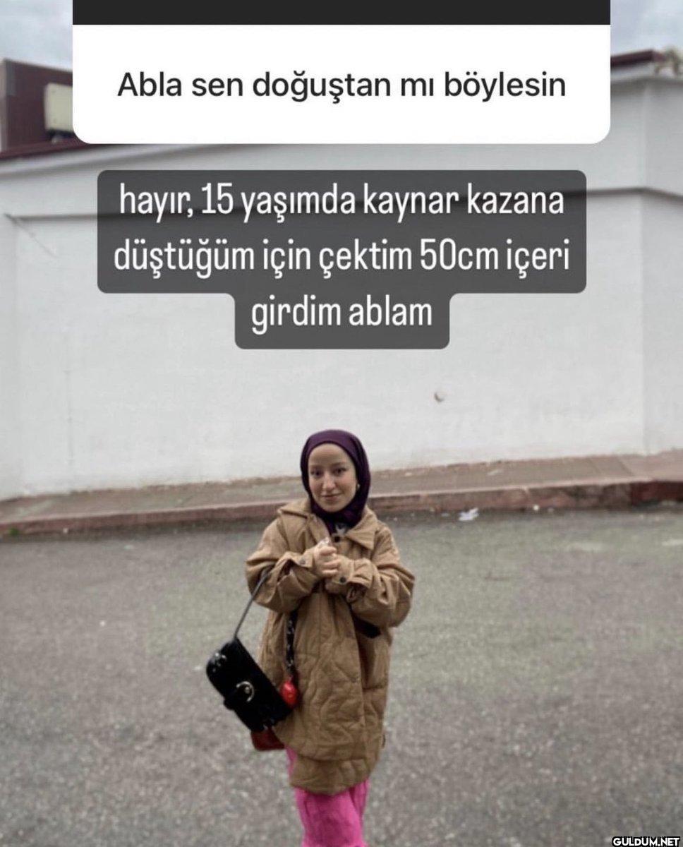 Abla sen doğuştan mı...