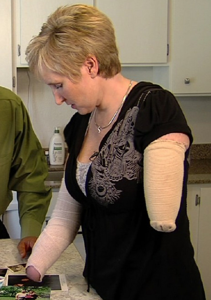 OBGYN was leaving abusive spouse, flipped car, lost hands