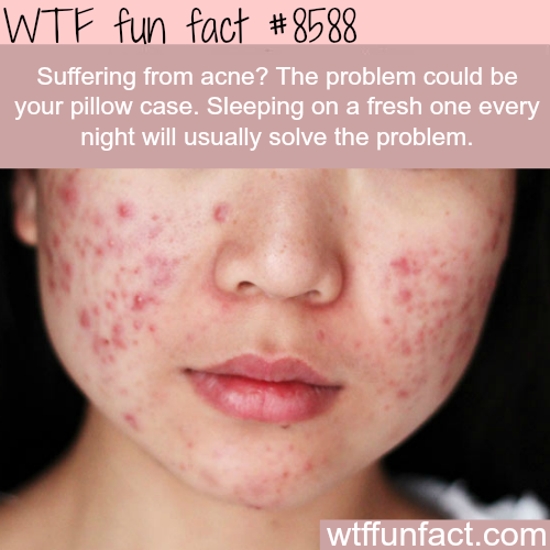 wtf-fun-factss:
“How to solve your acne problem - WTF fun facts
”