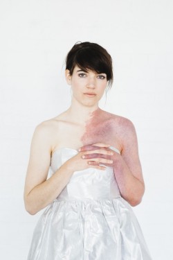 the-love-we-make:   Patience Hodgson, lead singer of the Australian band The Grates, grew up with a large, rare port wine stain birthmark, otherwise known as Klippel Trenaway Sydrome, covering half of her upper body. “I love my birthmark’s spectrum