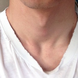 boxe:  I got neck freckles this week