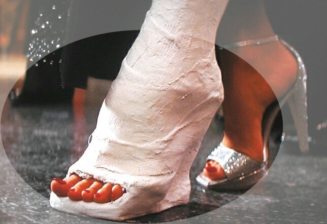 castdomgips:  der besondere High Heel