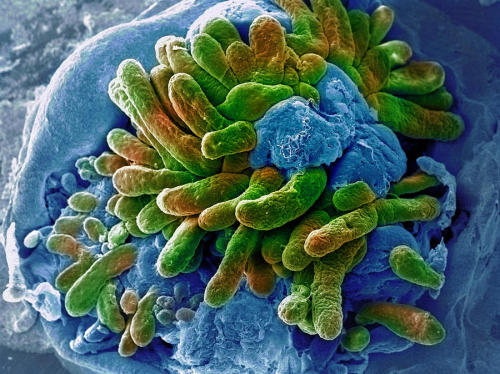 small intestine with villi in green, to keep it weird colored SEM, 50x credit: Stephanie Schuller