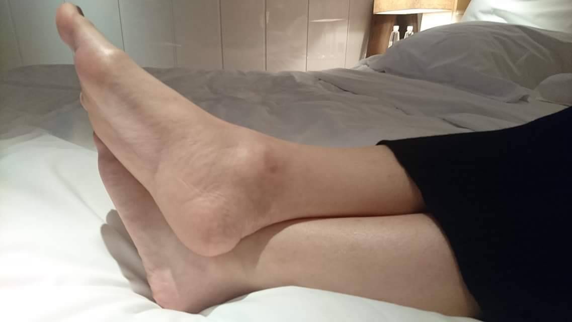 香港腳趾迷
