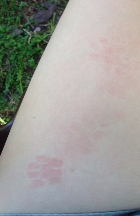 gardence: he left cute lil paw marks on my leg 