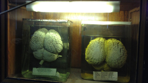 vicemag:  A Visit to Moscow’s Brain Institute, Where Stalin’s Brain Is Kept in a Jar On April 14, 1930, the Russian poet Vladimir Mayakovsky committed suicide in his Moscow apartment. His closest friends, including the writer Yuri Olesha, rushed to