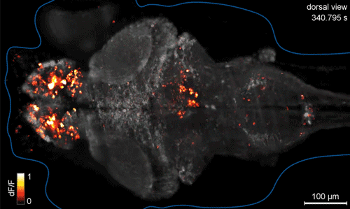 gif-not-jif:  This is a Brain need more gifs? 