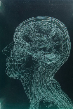 showslow:  Layered MRI Self-Portraits Engraved