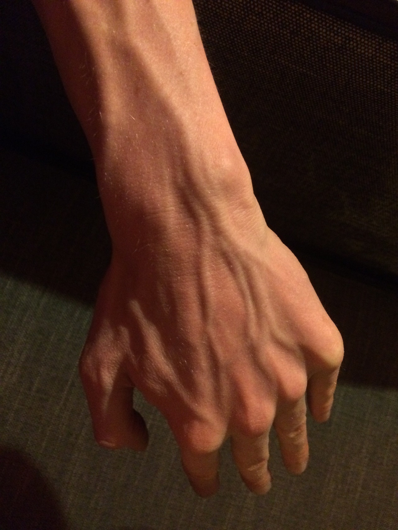 Veiny why arms do people have Veiny Arms: