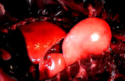 scabattoir:  Lung expansion gif from public