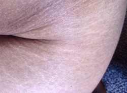 clearmind-healthybeing:  Flaws - 2016  I’ve been having a lot of confidence and body issues lately so I felt like it was time to post this. Things like my stretch marks, stomach hair, ribs, and stomach rolls have always been something I struggled with.