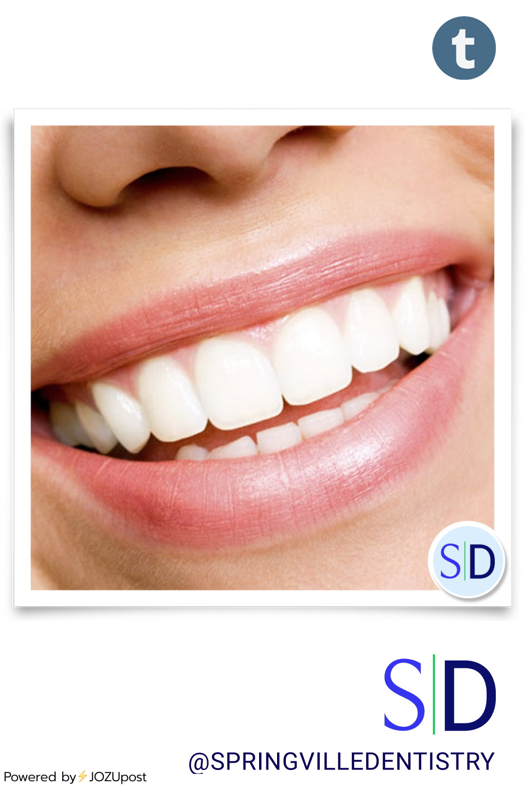 Discover the secrets of a beautiful smile! The most attractive smile shape is a gentle curve, while gummy smiles expose excess gum tissue. Different smiles, like the Duchenne smile or closed-lip smile, express varying emotions. Springville Dentistry...