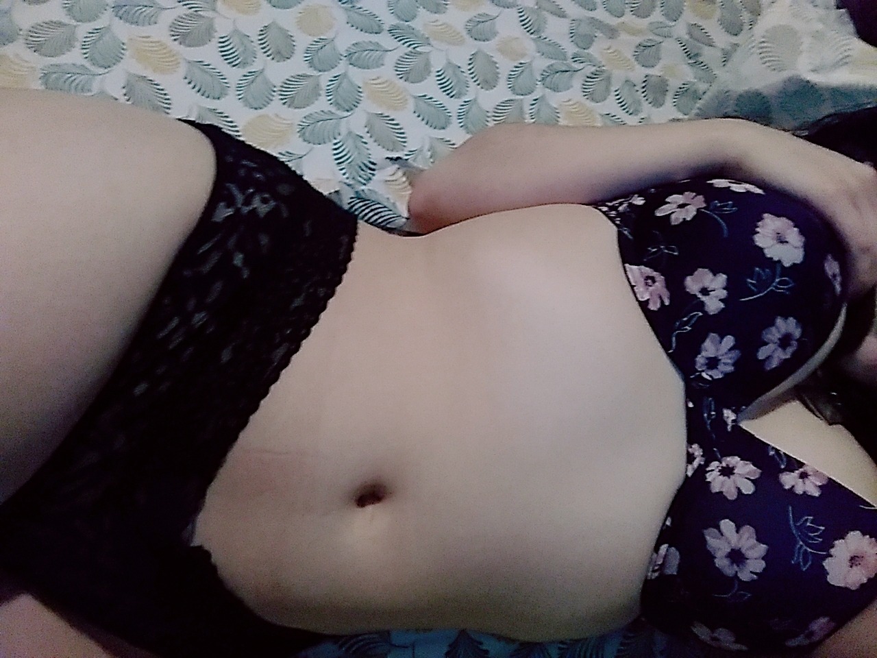 jaquiwithoutac:  My jeans left ugly marks on my tummy 