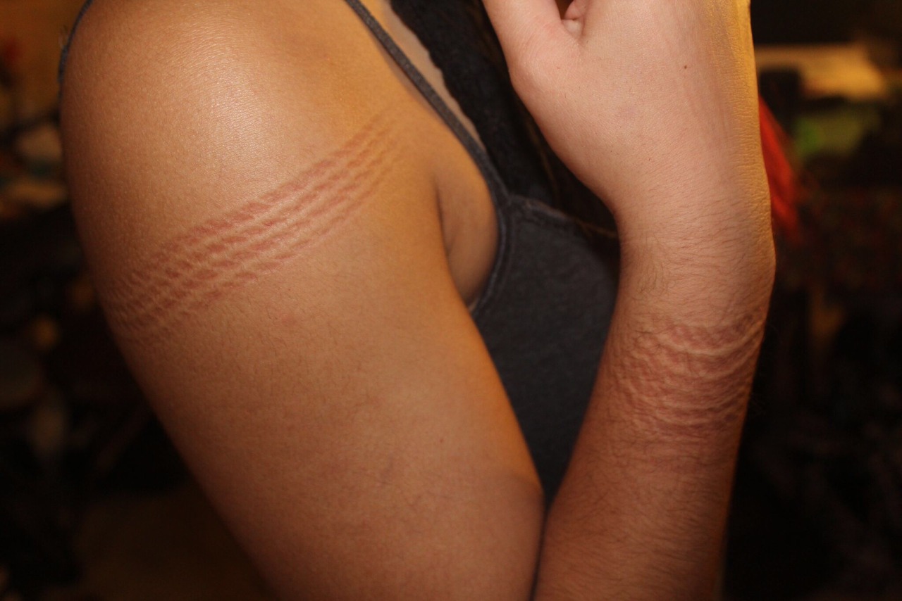 ropeandthings:  a-refreshing-reign:  Second rope day!  My back is kinda sore today,