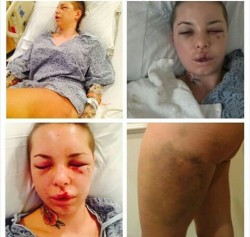 myl0vef0rpics:  Terrible smh.  Its so sad to have heard what happened to her  THEY NEED TO LOCK UP THE MOTHER FUCKER THAT DID THIS TO HER AND FUCK HIM UP!