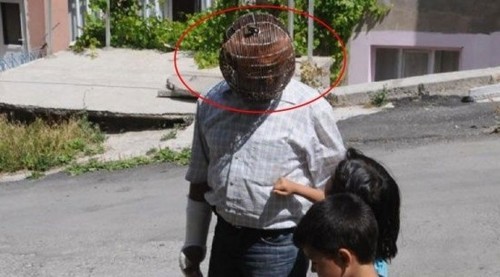 A Turkish man started wearing a copper wire cage on his head to quit smoking.