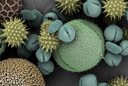 Pollen Mix-up | Cell The examination and study of pollen through advanced microscopy techniques can 