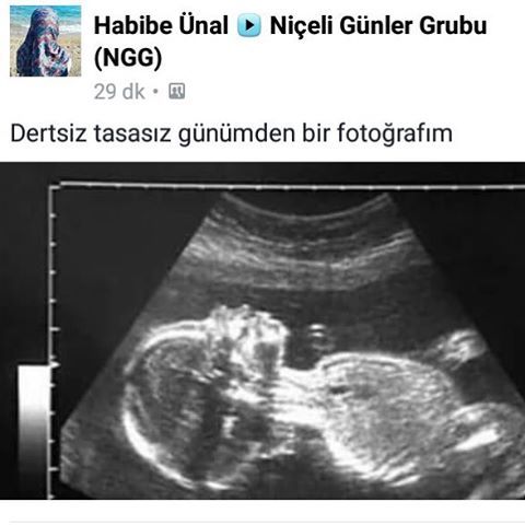 Habibe Unal
Niceli Günler...