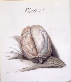 Lepromatosis:illustration Plates Taken From The Anatomy Of The Brain By Charles