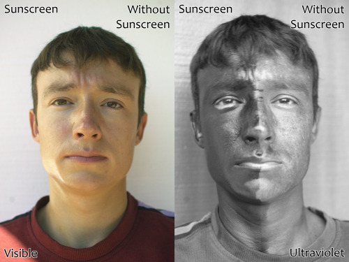 UV Photo with &amp; without sunscreen (by: burlyqlady)
