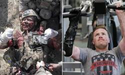 semperannoying:  Who does something like this? Look closely at the picture on the left. That’s Marine Gunnery Sgt. Brian Meyer. A bomb in Afghanistan had just blown off his leg, his hand, and three fingers on his other hand. And yet there he is smiling.