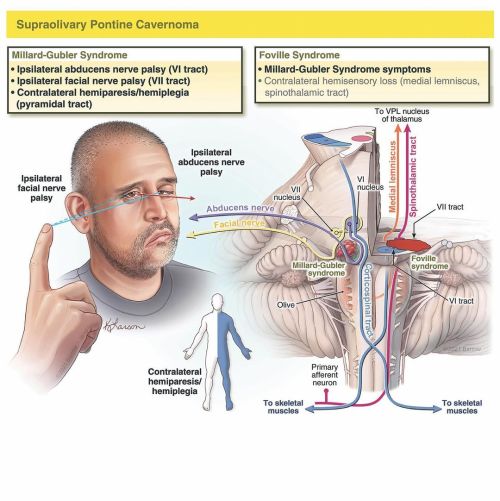 Illustrations created by @kristenlarsonkeil and @petermlawrence for a recently published article on 