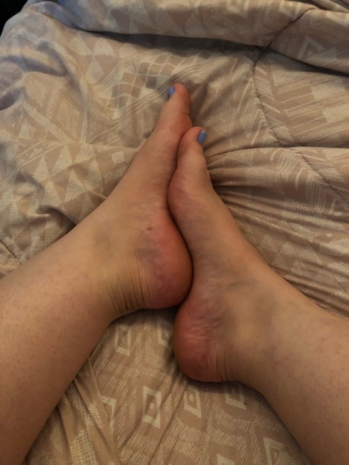 sierra-marie94: Finally got my toes done!
