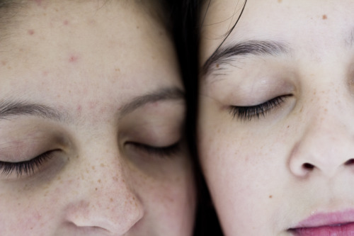 freckles porn pictures