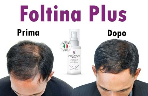 Foltina Plus funziona opinioni e prezzo.Sempre più persone cercano di affidarsi a prodotti se