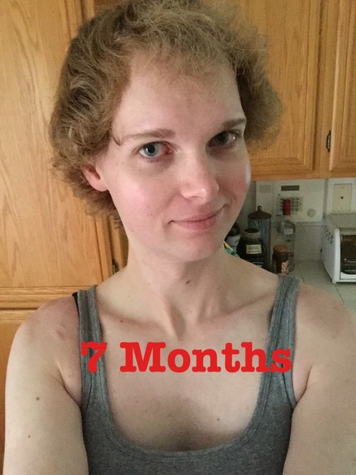 Porn lanaurbana:My full transition timeline from photos