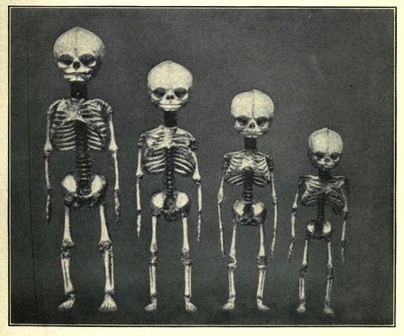 nemfrog: “Skeleton of a child from birth (right) to one year (left).” Pedagogical a
