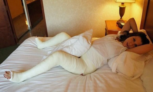Woman in hotel room with a white DHS cast leaning back on bed.  Found this on the Internet, I’d love