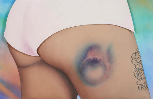 nevver:  Bruised, Rikka Hyvönen