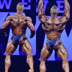 Dalthorn:   Dallas Mccarver - At The 2015 Olympia For His First Olympia And It’s