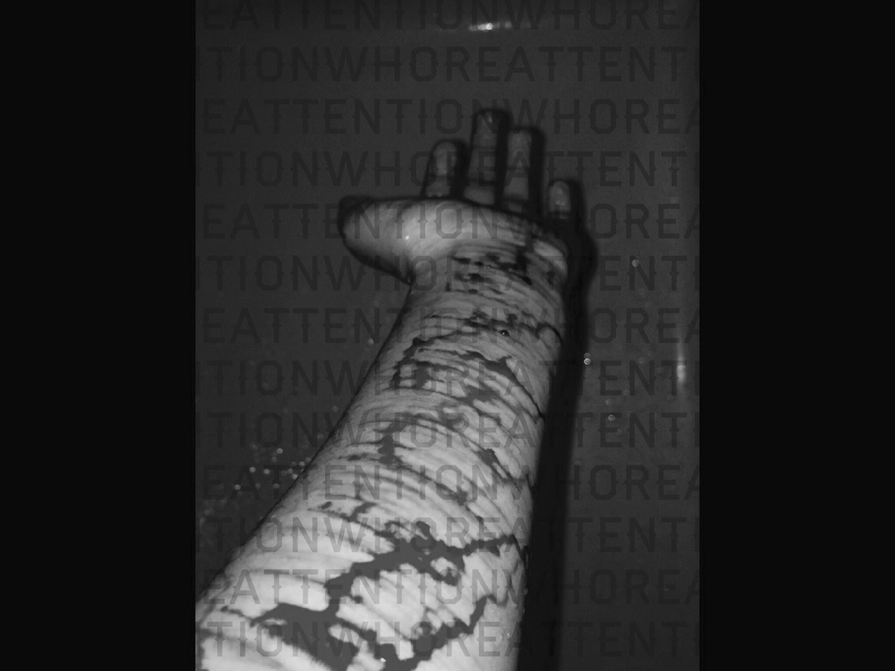happy-the-fuck-up:  I just want to kill myself. I don’t know why anymore, I just
