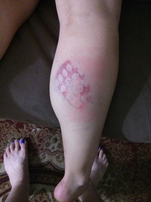 gothicdiscordian: littlefeministbitch:The process of marking my right calf over the Fourth of July