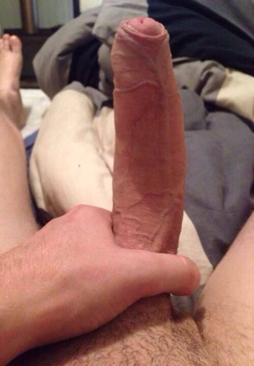 Freckles, Fur & Foreskin