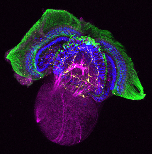 house-of-gnar:  Fluorescent Embryos  [Image 1] Chick ectopic limb. An FGF-4-soaked bead was implanted at stage 14. The embryo was fixed four days later, and stained with alcian blue to reveal the developing cartilage of the skeleton. An ectopic limb