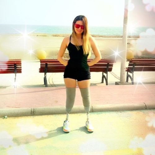 assymetric-beauty: The beautiful Shirley, now with prosthetic legs. So beauty