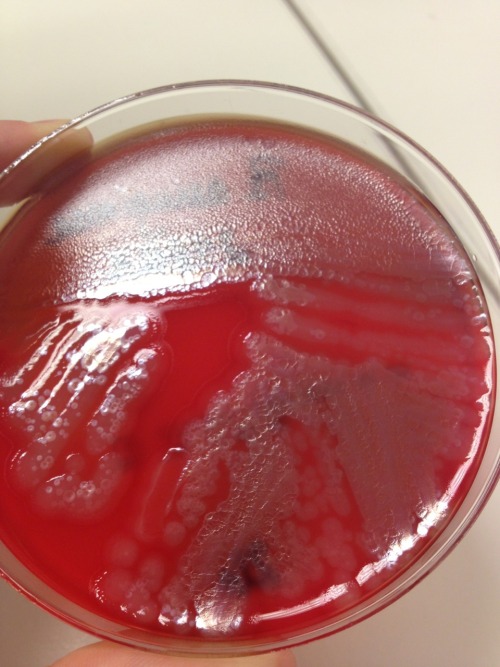 Pseudomonas Aeruginosa On Sheep Blood Agar.