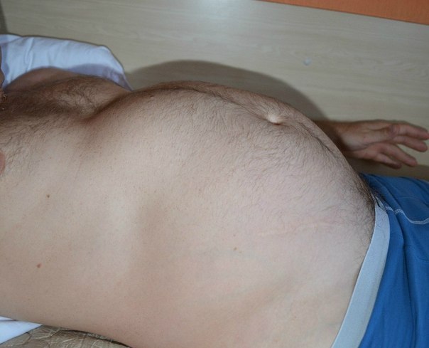 The Belly Sculptor