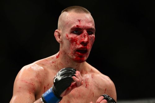 Mma fighter broken nose