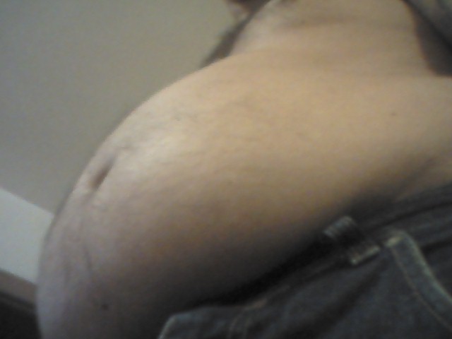 feedmealive:  See what overeating do! Â First picture is an old one and all the