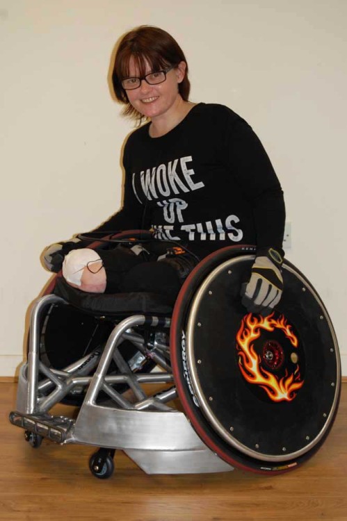 Lost her legs due to infection and CRPS