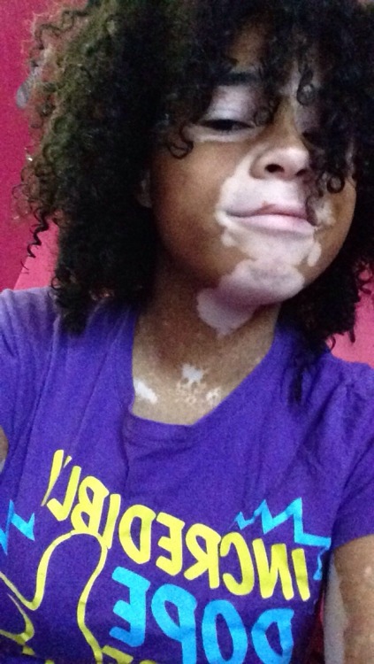 afatblackfairy:  kiirbsterr:  Look at my nose it’s cute  omfg cute cute cute